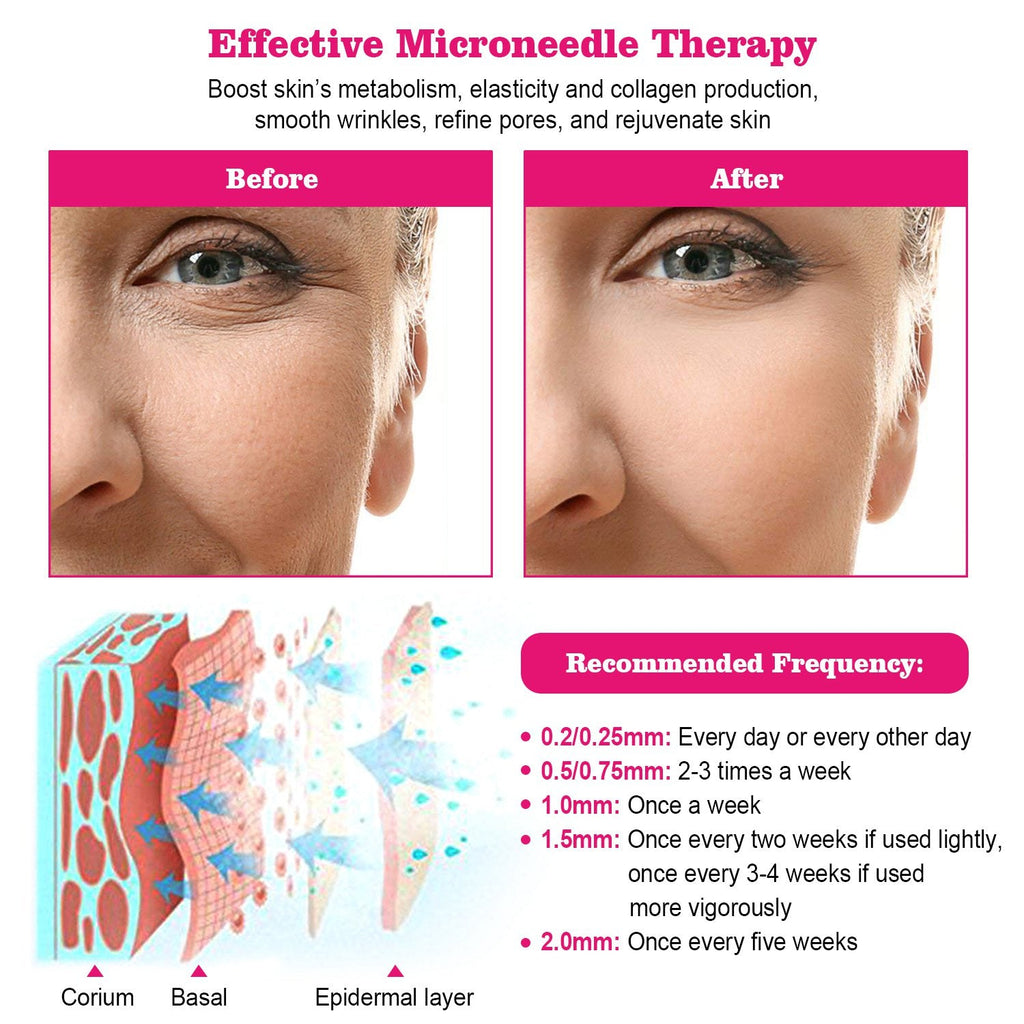 192Pcs Titanium Microneedles Facial Roller